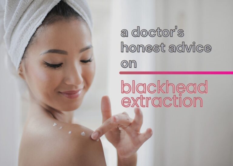a doctor's honest advice on blackhead extraction