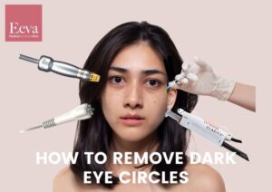 doctor guide to remove dark eye circle