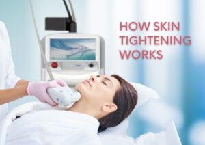 hifu facelift skin tightening laser