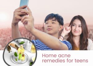 ● acne treatment in Singapore