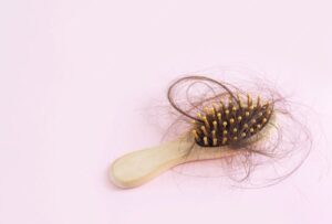 hair loss treatment singapore