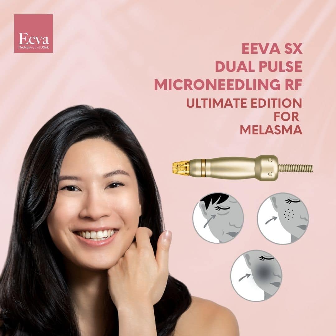 sylfirm x pigment melasma